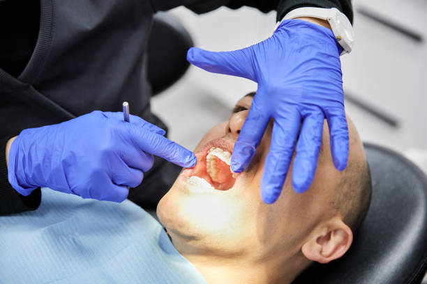 Best Emergency Broken Tooth Repair in Marshall, IL