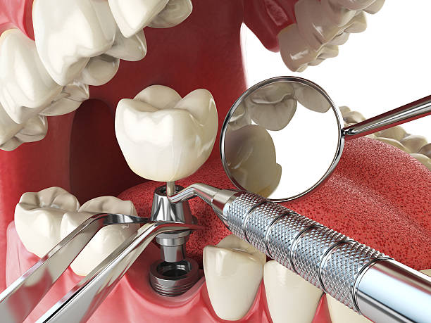  Marshall, IL Emergency Dentist Pros