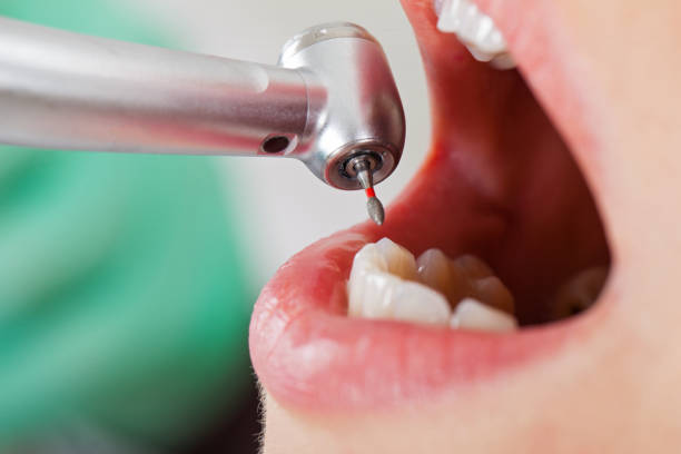 Best Weekend Emergency Dentist in Marshall, IL